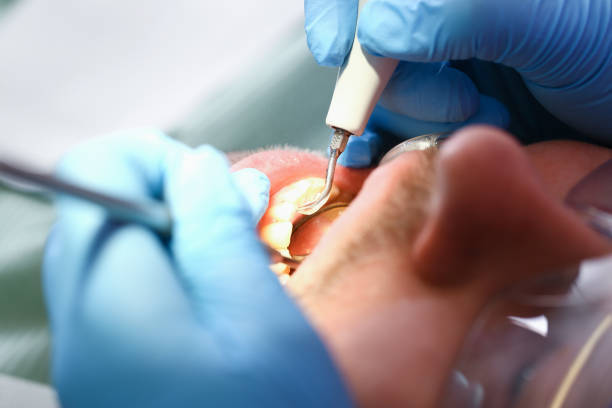 Best Cosmetic Emergency Dentistry in New California, OH