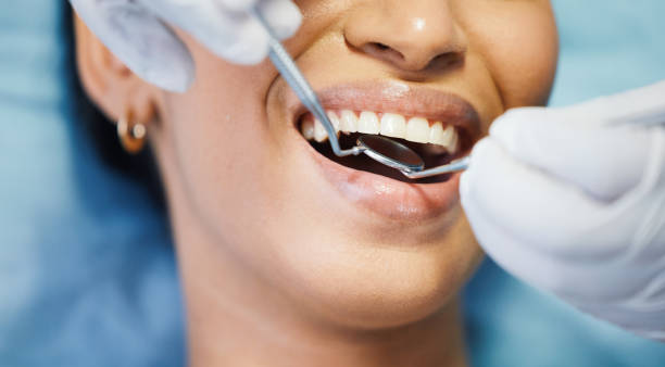 Best Urgent Care for Lost Fillings or Crowns in New California, OH